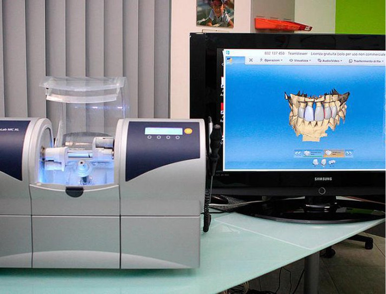 CAD/CAM